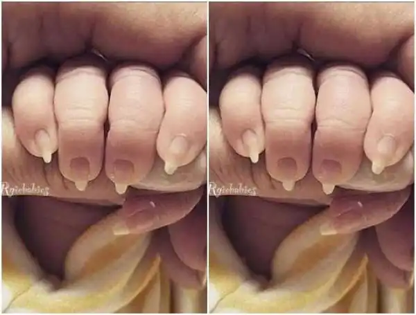 Checkout Viral Photo Of Baby Born With Long Nails
